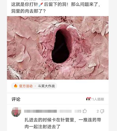 “打针的时候会留下一个洞,那么洞里的肉去哪里了呢?”确实令人疑惑,哈哈哈哈 “打针的时候会留下一个洞,那么洞里的肉去哪里了呢?”确实令人疑惑,哈哈哈哈