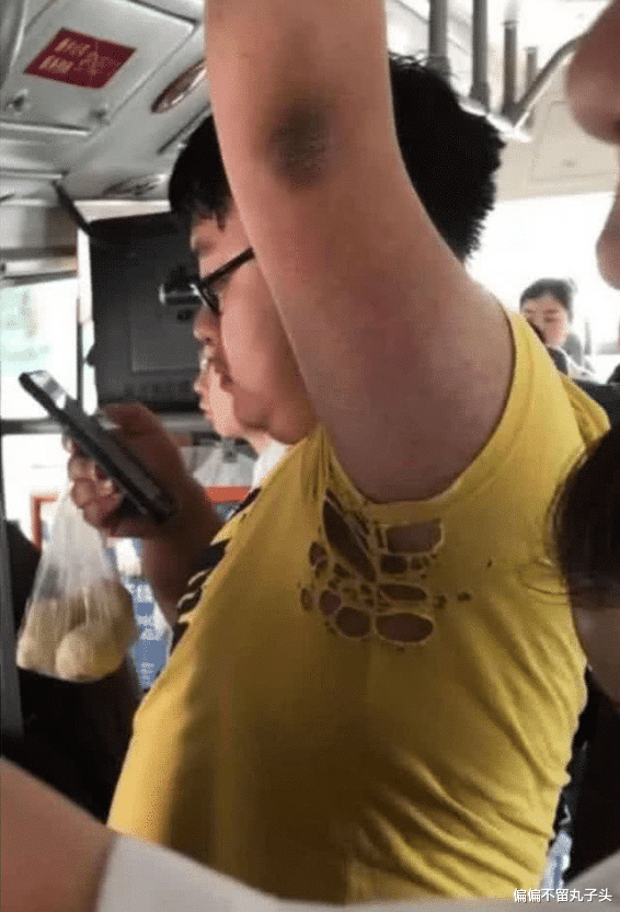 “为什么割腕会死,断臂却不会?”评论区神点评啊,哈哈哈哈哈 “为什么割腕会死,断臂却不会?”评论区神点评啊,哈哈哈哈哈