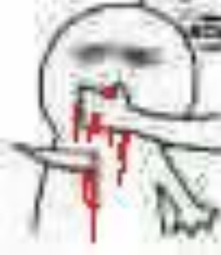 我一刀捅死你（鲜血直流）表情包