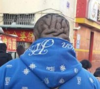 大哥，你这是大脑外露了是嘛