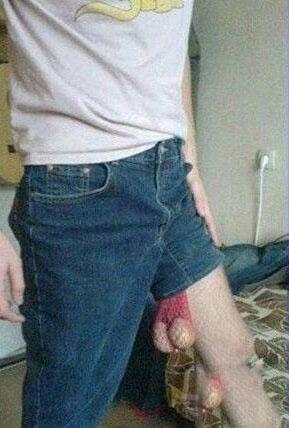 真的看到了两颗忧伤的蛋蛋 真的看到了两颗忧伤的蛋蛋