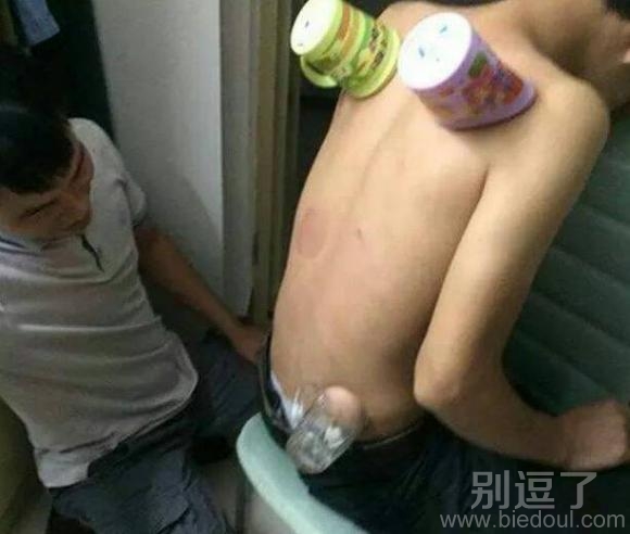 我宿舍舍长的帮我拔罐!